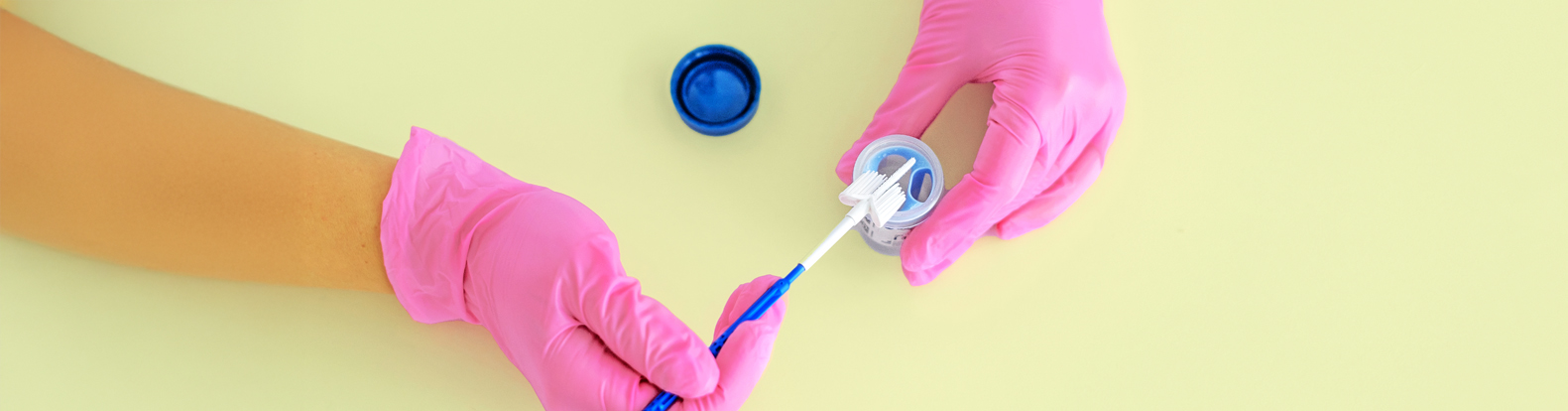 Cervical Screening and Colposcopy